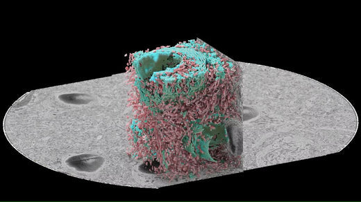 From Cross Sections to Volume : In-situ Microtome for SEM