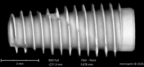 Dental implant